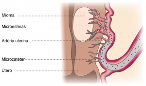 Imagem retirada do site SoBRICE